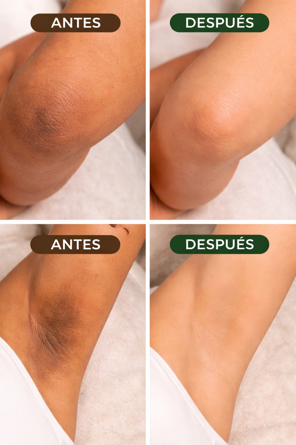 2x1 Jabón de Cúrcuma Natural Aclarante | Elimina Manchas, Zonas Oscuras y Grasa Rápido